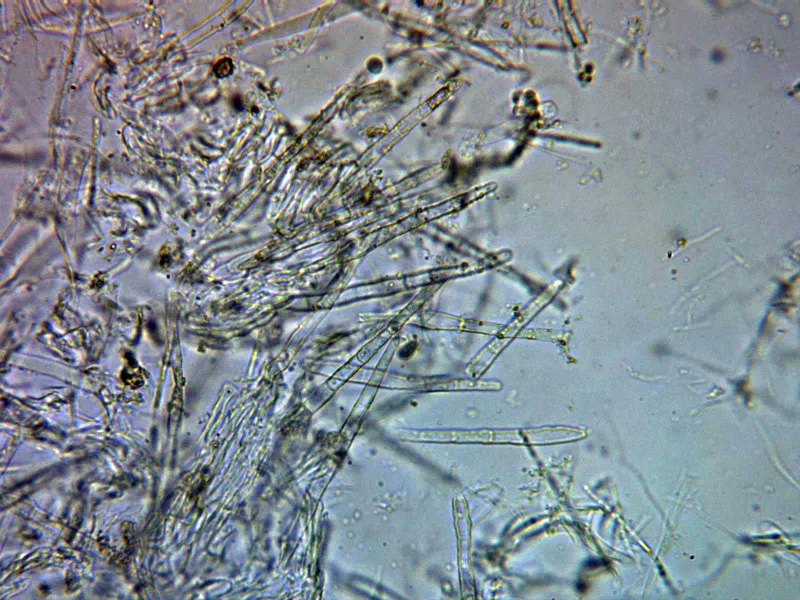 Arachnopeziza aurata 11 - Pelos agua x 400